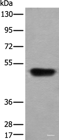 Western blot analysis of Human fetal liver tissue lysate  using HNRNPH2 Polyclonal Antibody at dilution of 1:400