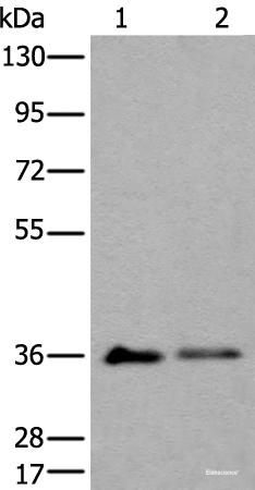 Western blot analysis of 293T cell lysates  using METAP1D Polyclonal Antibody at dilution of 1:600