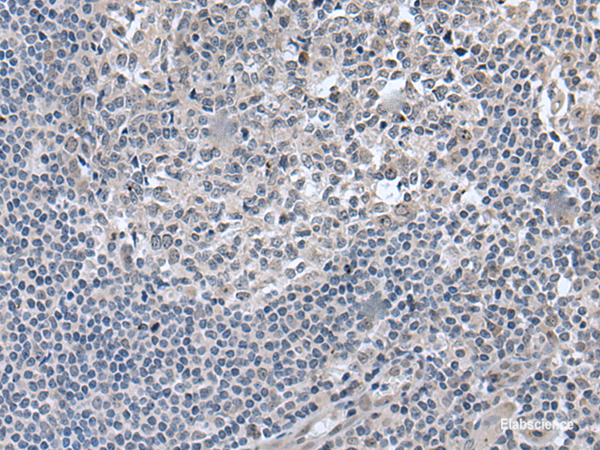 Immunohistochemistry of paraffin-embedded Human tonsil tissue  using EDARADD Polyclonal Antibody at dilution of 1:50(×200)