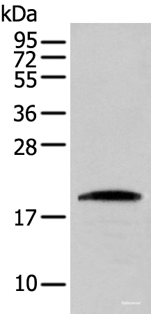 Western blot analysis of HEPG2 cell  using CNPY2 Polyclonal Antibody at dilution of 1:300