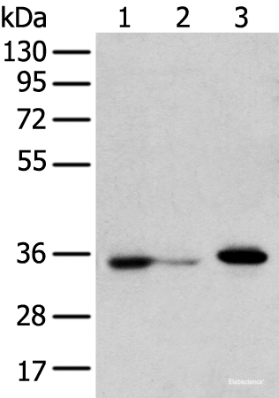 Western blot analysis of HepG2 cell Hela cell and A549 cell  using DHRSX Polyclonal Antibody at dilution of 1:350