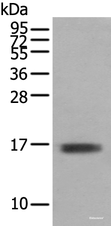 Western blot analysis of Mouse skeletal muscle tissue  using TNNC1 Polyclonal Antibody at dilution of 1:400