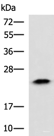 Western blot analysis of Human fetal liver tissue lysate  using ABHD14B Polyclonal Antibody at dilution of 1:900
