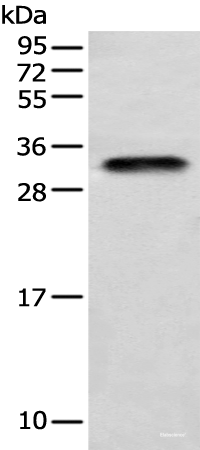 Western blot analysis of Human testis tissue  using LYPD4 Polyclonal Antibody at dilution of 1:400