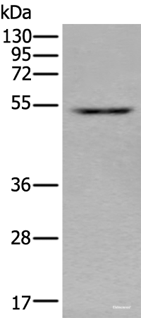 Western blot analysis of HEPG2 cell lysate  using ZNF672 Polyclonal Antibody at dilution of 1:350