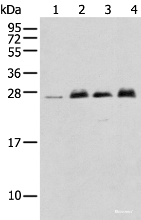 Western blot analysis of K-562 cell Mouse brain tissue Rat brain tissue Human fetal brain tissue  using MOB4 Polyclonal Antibody at dilution of 1:400