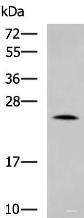 Western blot analysis of Mouse small intestines tissue lysate  using LYPLA1 Polyclonal Antibody at dilution of 1:1000