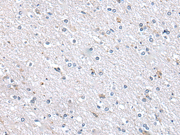 Immunohistochemistry of paraffin-embedded Human brain tissue  using METTL7A Polyclonal Antibody at dilution of 1:40(×200)