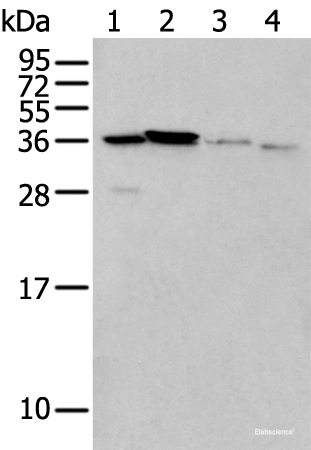 Western blot analysis of 293T cell Mouse brain tissue and Human kidney tissue lysates  using LASP1 Polyclonal Antibody at dilution of 1:350