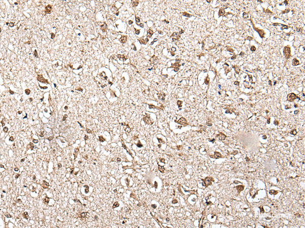 Immunohistochemistry of paraffin-embedded Human brain tissue  using ZFP36 Polyclonal Antibody at dilution of 1:55(×200)