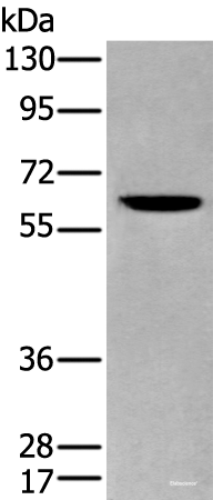 Western blot analysis of Human cerebrum tissue lysate  using ZKSCAN1 Polyclonal Antibody at dilution of 1:400