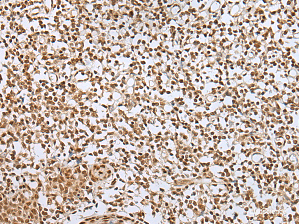 Immunohistochemistry of paraffin-embedded Human tonsil tissue  using ZNF354A Polyclonal Antibody at dilution of 1:40(×200)