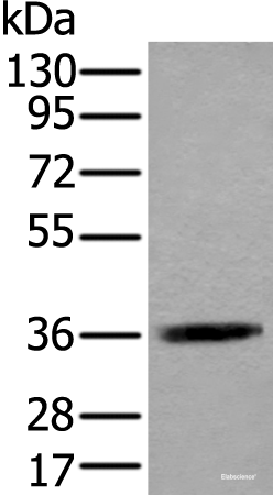 Western blot analysis of Jurkat cell lysate  using ACAT2 Polyclonal Antibody at dilution of 1:550