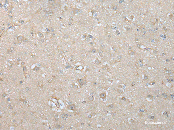 Immunohistochemistry of paraffin-embedded Human brain tissue  using VILL Polyclonal Antibody at dilution of 1:65(×200)