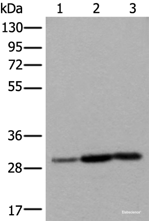 Western blot analysis of Human heart tissue A431 cell Human fetal liver tissue lysates  using SNRPA Polyclonal Antibody at dilution of 1:550