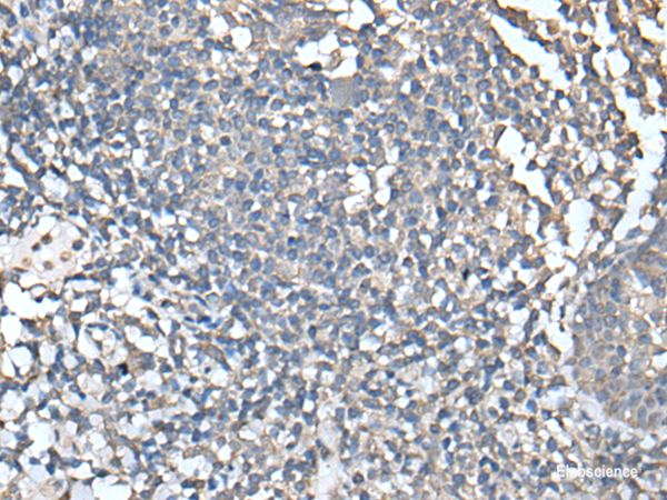 Immunohistochemistry of paraffin-embedded Human tonsil tissue  using UBASH3A Polyclonal Antibody at dilution of 1:50(×200)