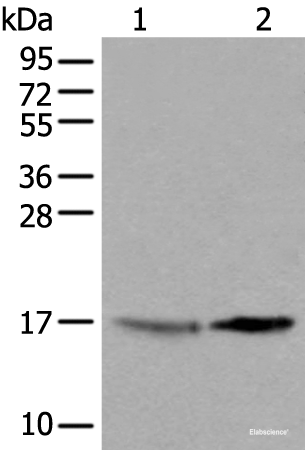 Western blot analysis of 231 cell and Human cerebrum tissue lysates  using UBE2W Polyclonal Antibody at dilution of 1:550
