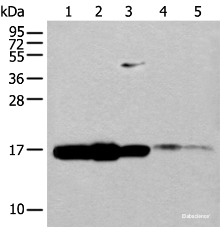 Western blot analysis of 293T cell Mouse spleen tissue and Human spleen tissue lysates  using UBE2V1 Polyclonal Antibody at dilution of 1:400