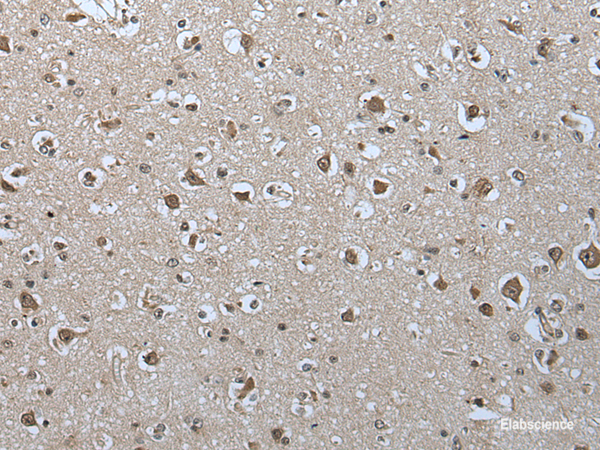 Immunohistochemistry of paraffin-embedded Human brain tissue  using USP35 Polyclonal Antibody at dilution of 1:55(×200)