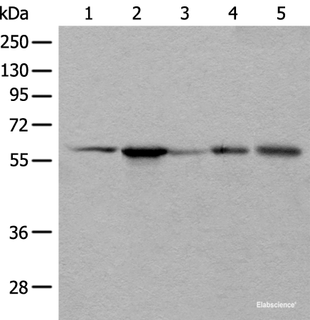 Western blot analysis of HEPG2 Hela A172 A549 and A431 cell lysates  using BAIAP2L1 Polyclonal Antibody at dilution of 1:800