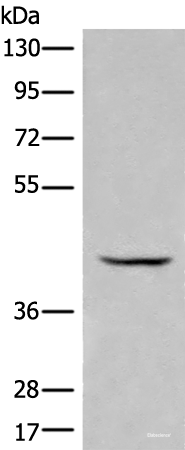 Western blot analysis of Human kidney tissue lysate  using BBOX1 Polyclonal Antibody at dilution of 1:650