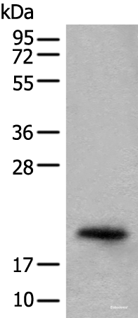 Western blot analysis of Mouse eye tissue lysate  using CRYGS Polyclonal Antibody at dilution of 1:800