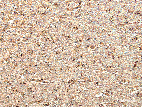 Immunohistochemistry of paraffin-embedded Human brain tissue  using MCPH1 Polyclonal Antibody at dilution of 1:40(×200)