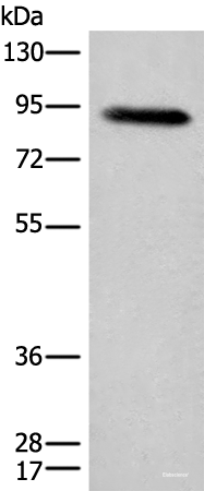 Western blot analysis of Human plasma solution  using C1R Polyclonal Antibody at dilution of 1:800