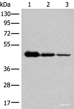 Western blot analysis of HEPG2 Hela and A549 cell lysates  using NADK2 Polyclonal Antibody at dilution of 1:600