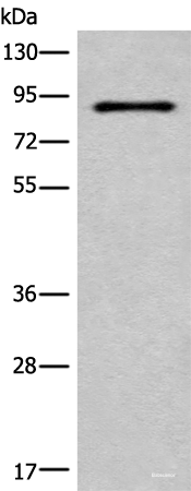 Western blot analysis of HUVEC cell lysate  using C7 Polyclonal Antibody at dilution of 1:800