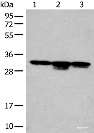 Western blot analysis of RAW264.7 cell Mouse kidney tissue and Mouse heart tissue lysates  using CA7 Polyclonal Antibody at dilution of 1:400