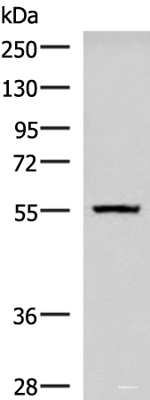 Western blot analysis of Human cerebella tissue lysate  using CAMKK1 Polyclonal Antibody at dilution of 1:700