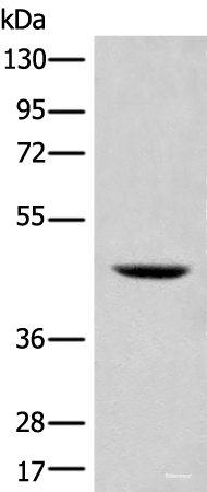 Western blot analysis of 293T cell lysate  using SHPK Polyclonal Antibody at dilution of 1:500