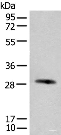 Western blot analysis of Human urinary bladder tissue lysate  using CFHR2 Polyclonal Antibody at dilution of 1:550
