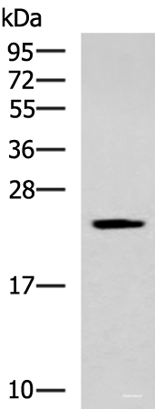 Western blot analysis of Human fetal liver tissue lysate  using CMPK1 Polyclonal Antibody at dilution of 1:700
