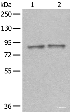 Western blot analysis of Mouse brain tissue and Rat brain tissue lysates  using DDX1 Polyclonal Antibody at dilution of 1:300