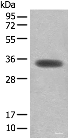 Western blot analysis of Mouse skeletal muscle tissue lysate  using MYOZ2 Polyclonal Antibody at dilution of 1:450