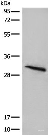 Western blot analysis of Mouse lung tissue lysate  using ITM2B Polyclonal Antibody at dilution of 1:400