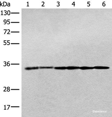 Western blot analysis of Jurkat cell Human breast cancer tissue Hela cell Human fetal brain tissue Human cerebrum tissue Rat brain tissue lysates  using PITPNB Polyclonal Antibody at dilution of 1:400