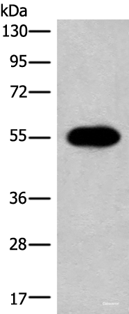 Western blot analysis of A549 cell lysate  using HAS3 Polyclonal Antibody at dilution of 1:300
