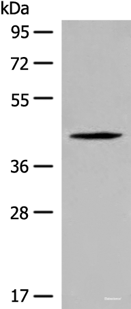 Western blot analysis of Jurkat cell lysate  using QTRT1 Polyclonal Antibody at dilution of 1:450
