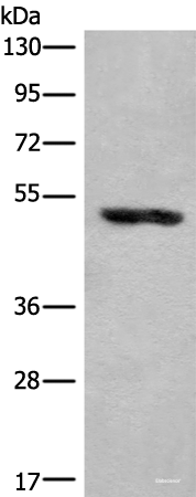 Western blot analysis of Human placenta tissue lysate  using KLHDC2 Polyclonal Antibody at dilution of 1:400