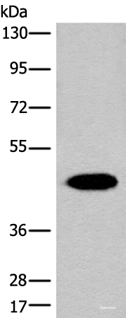 Western blot analysis of Human liver tissue lysate  using FAH Polyclonal Antibody at dilution of 1:700