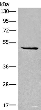 Western blot analysis of HL-60 cell lysate  using SPOCK3 Polyclonal Antibody at dilution of 1:400