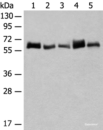 Western blot analysis of K562 and A172 cell Human bladder transitional cell carcinoma grade 2-3 tissue NIH/3T3 cell Mouse liver tissue lysates  using CCDC47 Polyclonal Antibody at dilution of 1:300