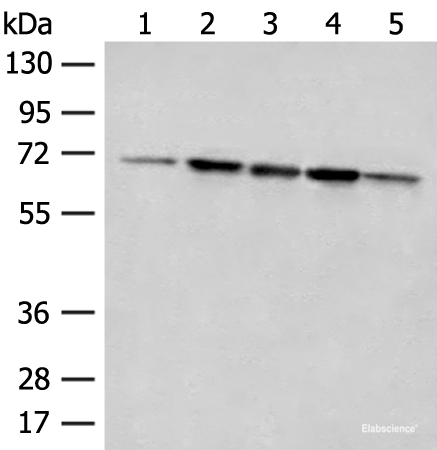 Western blot analysis of 293T cell Rat liver tissue A172 and Jurkat cell lysates  using ACSF2 Polyclonal Antibody at dilution of 1:400