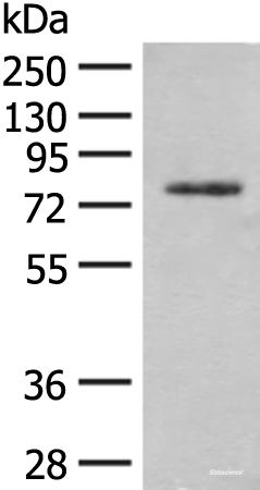 Western blot analysis of Hela cell lysate  using TRMT1 Polyclonal Antibody at dilution of 1:300