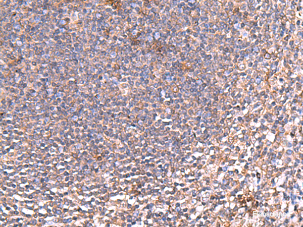 Immunohistochemistry of paraffin-embedded Human tonsil tissue  using PDRG1 Polyclonal Antibody at dilution of 1:80(×200)