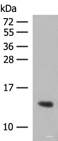 Western blot analysis of Human plasma solution  using HBG1:HBG2 Polyclonal Antibody at dilution of 1:350