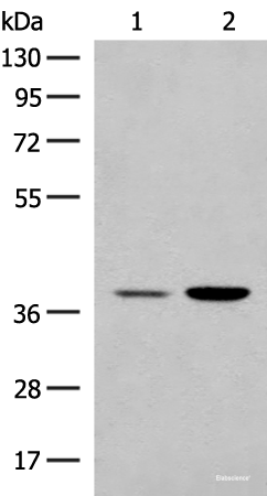 Western blot analysis of HEPG2 and K562 cell lysates  using MRM1 Polyclonal Antibody at dilution of 1:400